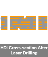 HDI